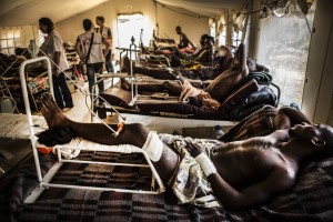 La mayoría de los heridos han sido por disparos en la pierna. Foto: Juan Carlos Tomasi (MSF)