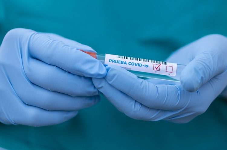 coronavirus covid