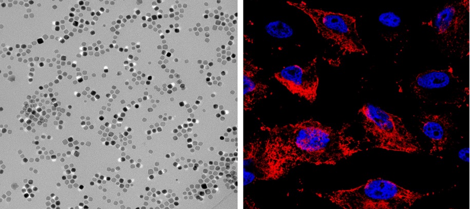 Nano4zombie: eliminar células tumorales con nanopartículas magnéticas