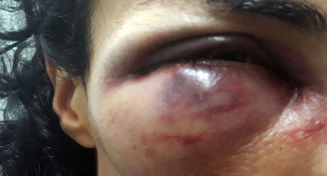 Una de las mujeres fue agredida, hasta en tres ocasiones, con la porra en la cara.