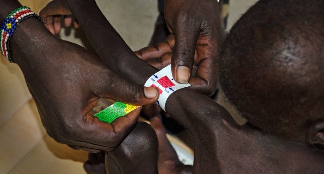 Gatluok, de dos años, en la sala de espera de centro ambulatorio de alimentación terapéutica del hospital de Leer, en el estado de Unidad, Sudán del Sur. Le hacen la prueba del MUAC (circunferencia braquial). Su Muac mide solo 94 mm, En mitad del área roja, indicando que tiene desnutrición aguda severa. Foto: Nick Owen (MSF)