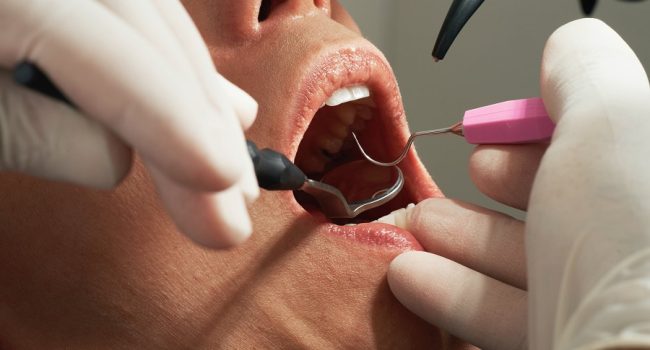 Incertidumbre ante “la falta de recursos” de la DGA para la Atención Bucodental