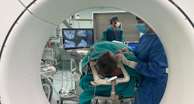 Intervención de neurocirugía