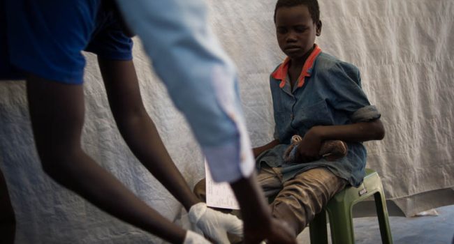 Un niño con una herida infectada en la tienda de apósitos de una clínica de MSF en el campamento para personas desplazadas en los terrenos de la misión de las Naciones Unidas para Sudán del sur (UNMISS) base en Juba, Sudán del sur, 12 de enero de 2014. Foto: Phil Moore