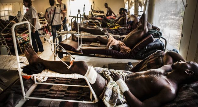 La mayoría de los heridos han sido por disparos en la pierna. Foto: Juan Carlos Tomasi (MSF)