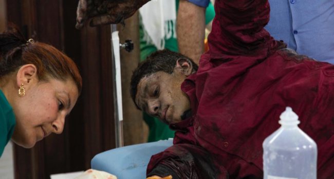 Un joven kurdo herido por las bombas turcas en Rojava. Foto: ANF