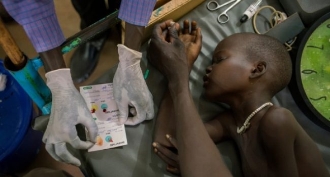 Adut recibe medicación para la malaria cerebral en el centro de MSF en Aweil, Sudán del Sur. Foto: © Diana Zeyneb Alhindawi