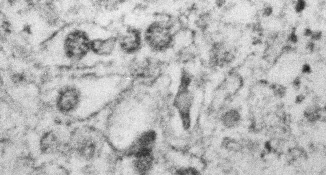 coronavirus unizar aragon 1