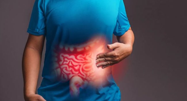 Enfermedad de Crohn.