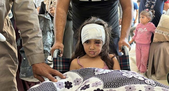 Foto de archivo de una misión de la ONU en el norte de Gaza que ayudó a trasladar a algunos pacientes, como esta niña, del Hospital Kamal Adwan al Hospital Al-Shifa. | Foto: ONU
