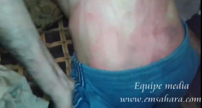 Imagen del vídeo difundido por Equipe Media donde se muestran las torturas.