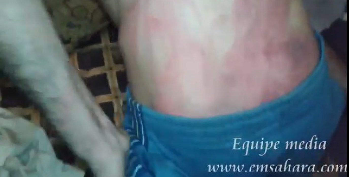 Imagen del vídeo difundido por Equipe Media donde se muestran las torturas.